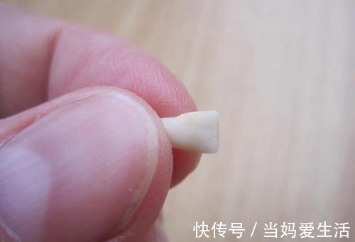 消毒|孩子这颗牙有大“作用”,父母别再乱丢了,关键时刻能救娃一命