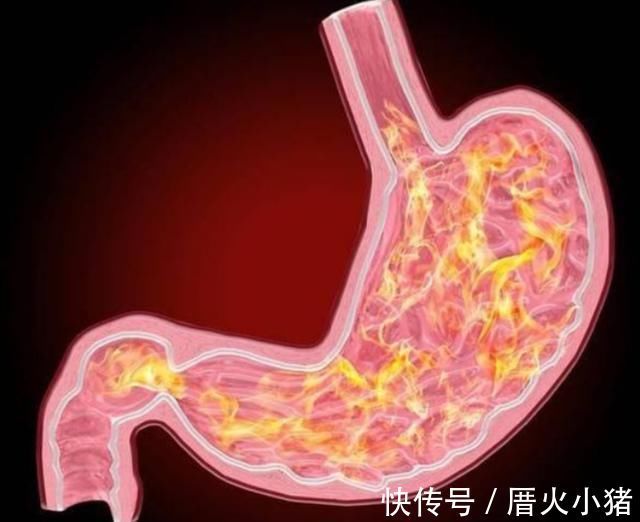 肠胃不好|医生建议：想养胃的人，这4类蔬菜尽量少吃，或能让肠胃健康点