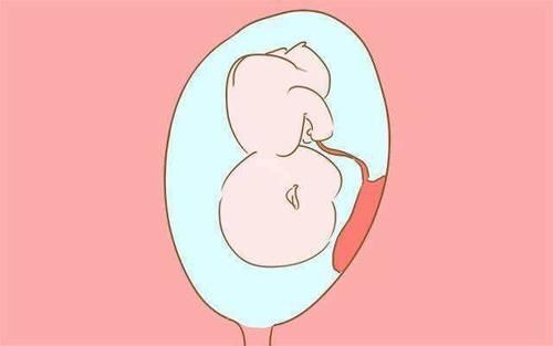 叶酸|满足以下任何一项,你都属于“高危孕妇”,孕期一定要悠着点!