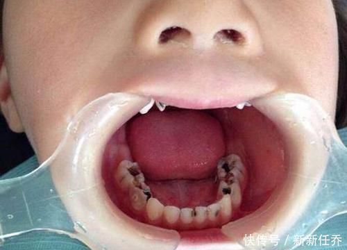 孩子|没营养还贵,这类“假牛奶”比真牛奶还畅销,多少孩子发育被毁