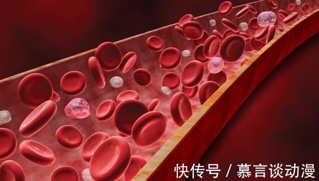 饮食习惯|茄子属于高血脂的“发物”吗?医生:预防高血脂,这3物尽量少吃