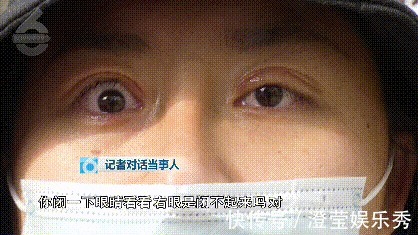 右眼|比原来丑这么多!女子花钱整成“阿凡达”眼睛都闭不上:“昨晚又是一夜没睡”
