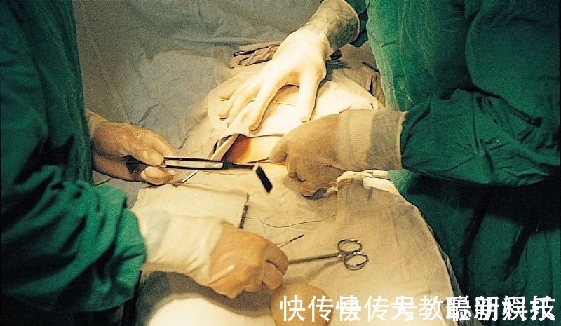 孕妈|剖腹产只是“挨一刀”就完事看完手术全过程,忍不住心疼女人