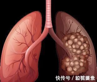 无氧运动|总是半夜三更醒来,别简单以为是失眠,或是3种疾病来袭,别大意