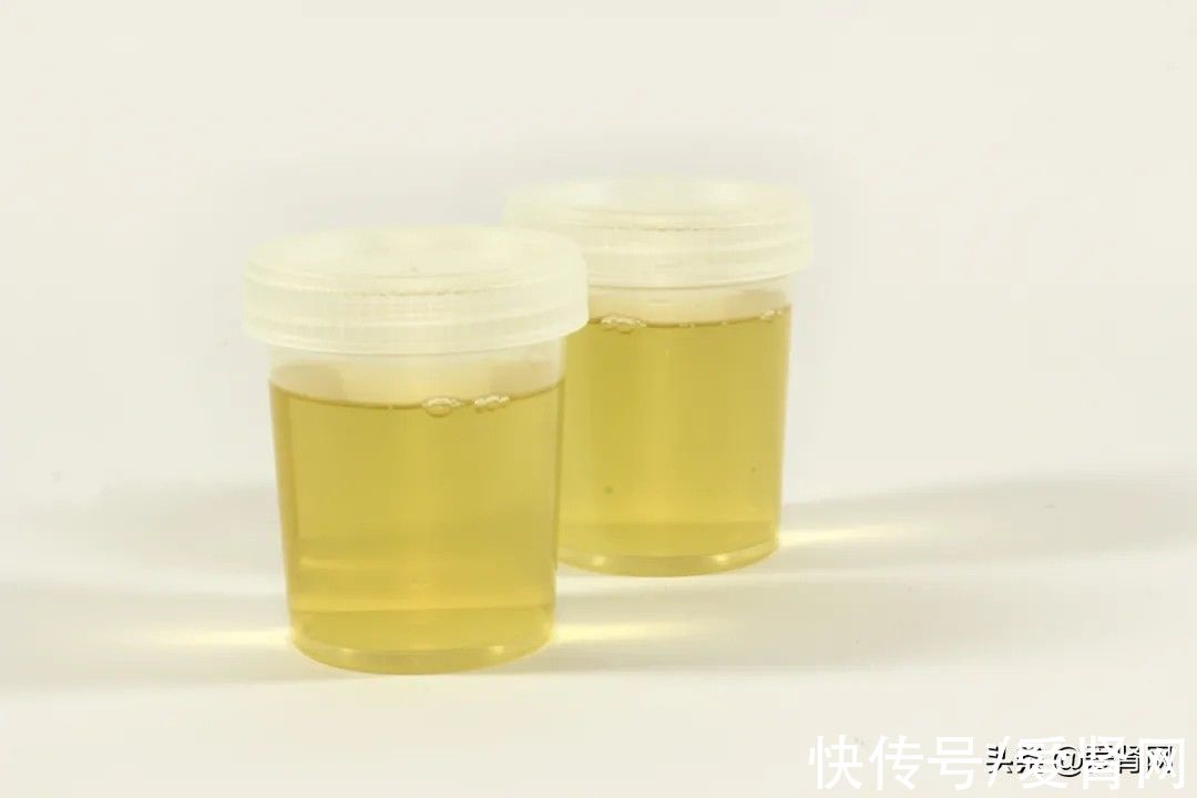 高发症|「肾友须知」代谢综合征——慢性肾脏病患者的高发症