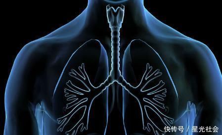 上门|肺部长了三种结节，最好及时手术切除，不然癌症有可能会找上门