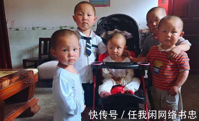 医科大学|男孩发生意外失去半个脑壳,父亲自责,只想给孩子一个正常脑袋