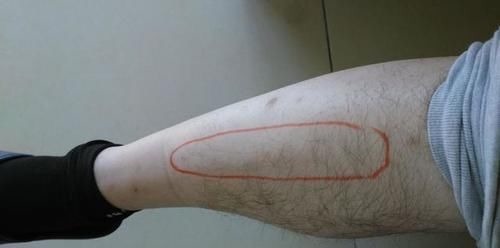 出血脂|血脂高不高,”小腿“先知?医生:血脂偏高,身体或有这几个表现