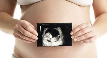 孕检|孕检这3项过关，妈妈就不用担心了，宝宝会健康出生