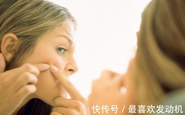 黑头|最近一款“变态洁面皂”火了,比洗面奶好用,用后黑头痘痘消失了!