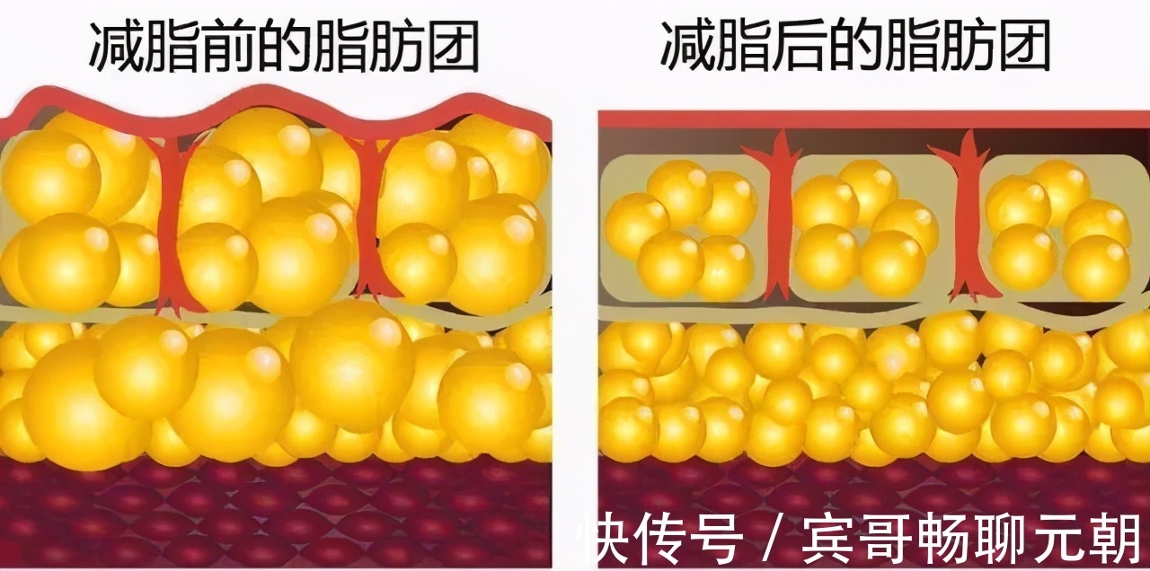 脂肪肝|为什么中年人腹部脂肪会越来越多3条建议助你恢复良好体态