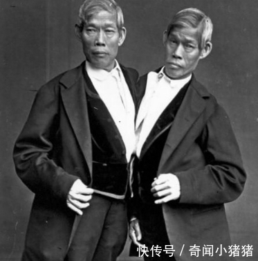 受精卵|连体哥哥爱上英国姑娘,弟弟每次只能回避,姑娘想一招三人都幸福