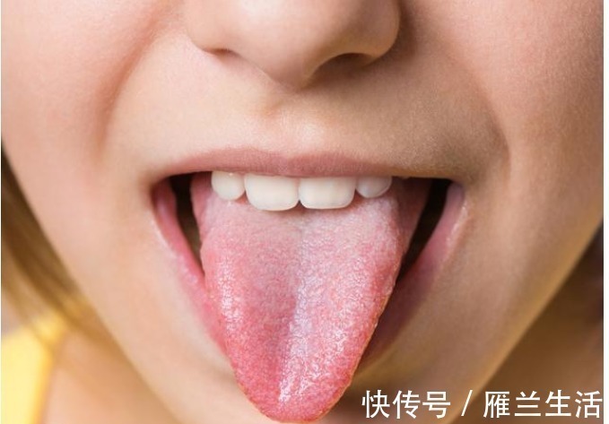 黄苔|舌头是一张健康晴雨表，好坏都写在它身上，癌症也是