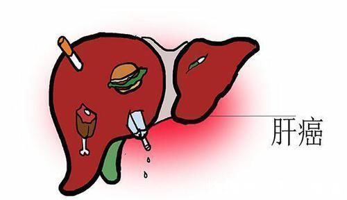 夫妻之间|医生实言相告三种癌症可能在夫妻间传染,为了爱人了解下