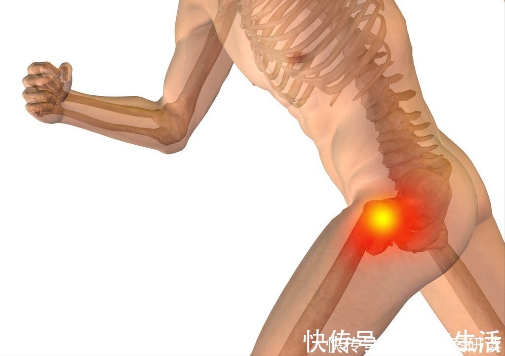 要穴|环跳穴，髋部及下肢疼痛的要穴；医生说：有三个功效，一个待验证
