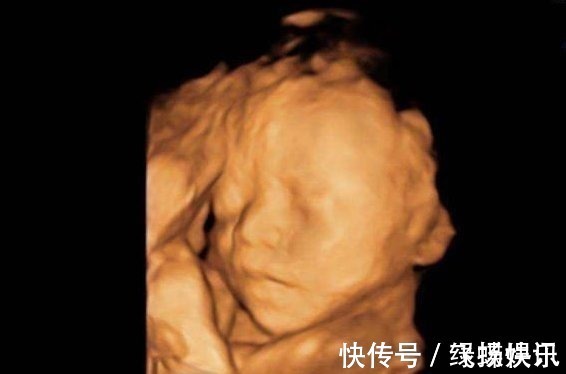 白花钱|孕妈做“四维”前,这3件事最好要提前了解,不然可能就是白花钱