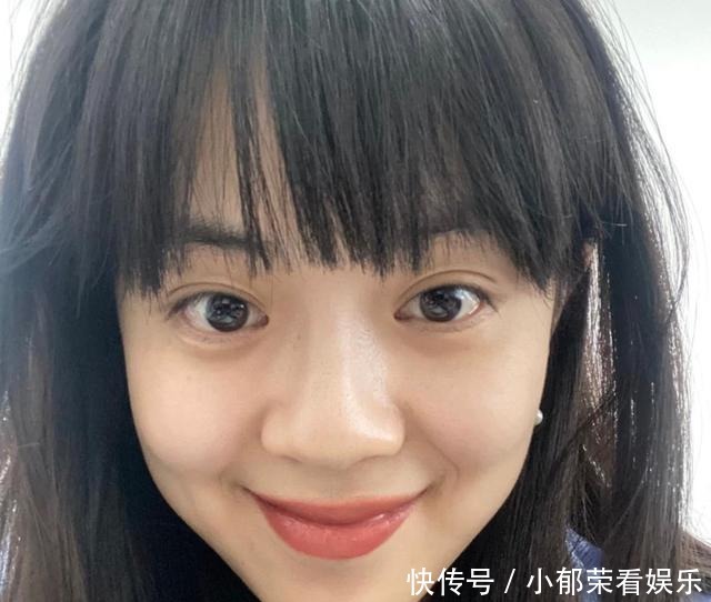 脸部|整容失败的“风险”有多大？额头凹陷、眼皮肉条，看完你还心动吗