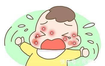 宝宝|宝宝长湿疹咋办？解决方案来了！