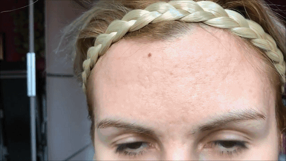 爱豆们竞当医美达人？男性适合的轻医美项目top5合集