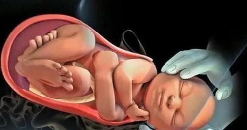 产妇|顺产比剖腹产强100倍？剖腹产这3大优点，顺产根本没法比