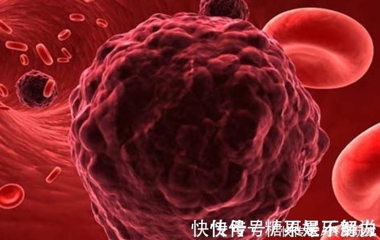 癌症|肿瘤手术后复发的几率是多少?做好4件事,或许有助降低复发率