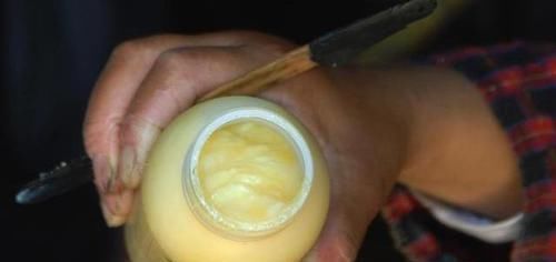 女人查出子宫肌瘤，若贪吃3物，可能会加速肌瘤生长，劝你管住嘴