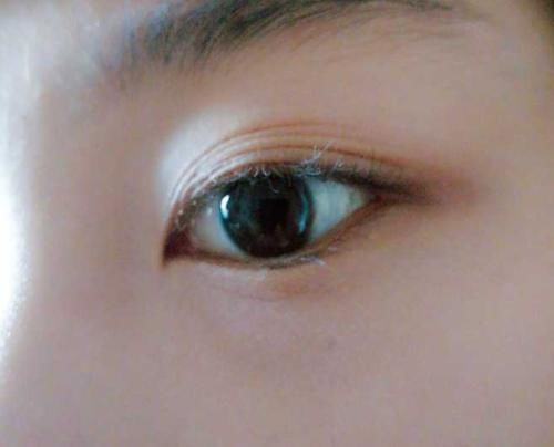 你的眼皮都有几层了?