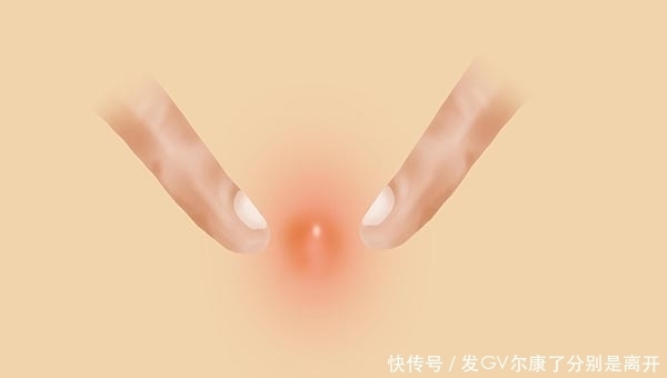 鼻子两侧挤出来的白色条状物，是什么？为何出现越挤越多的情况？