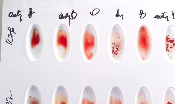 抗体|O型血妈妈,为什么要珍惜第一胎?这种病症,需要提前了解