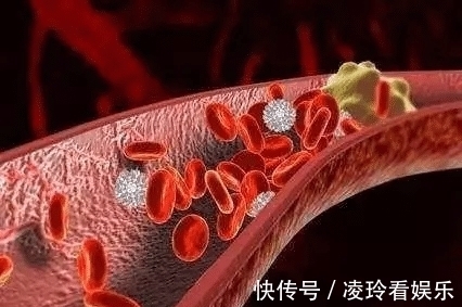 血栓类|小心!糖尿病会并发致命心梗,早期预防很关键