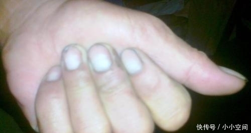 长寿|人到中年想长寿,若身上3处不发白,恭喜你离长寿又近一步!