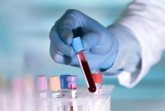 大医典|医生提醒：血脂过高的人，3种素食尽量少吃，升脂不比肥肉慢！