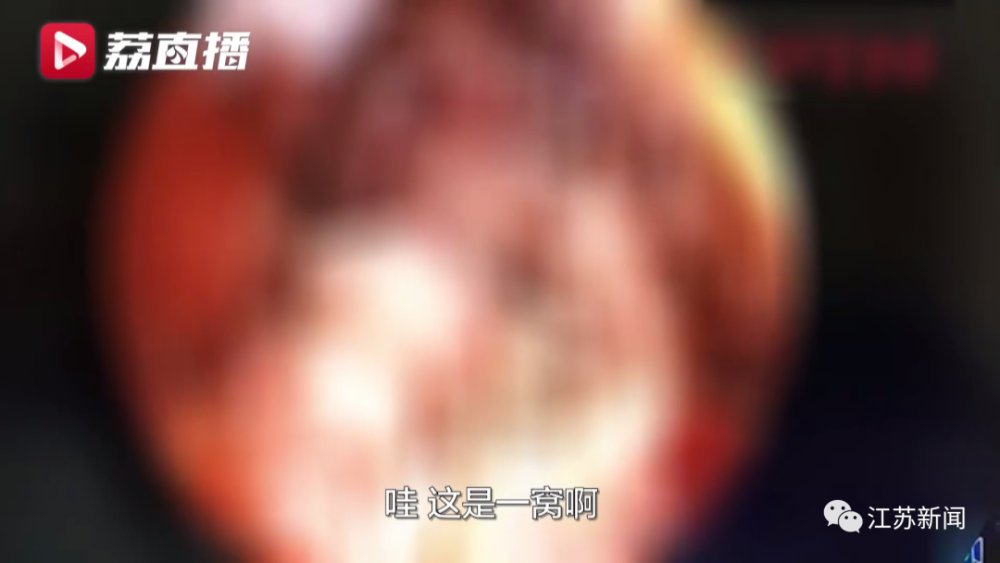 鼻子|八旬大爷鼻子发痒,医生竟从里面取出36条蛆