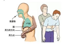 喉镜|2岁幼童脸色发紫，急送余姚中医院抢救！这个教训现在看还不晚