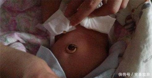 婴儿囟门|宝宝这5个部位坚决不能乱碰,当你知道后悔都晚了!