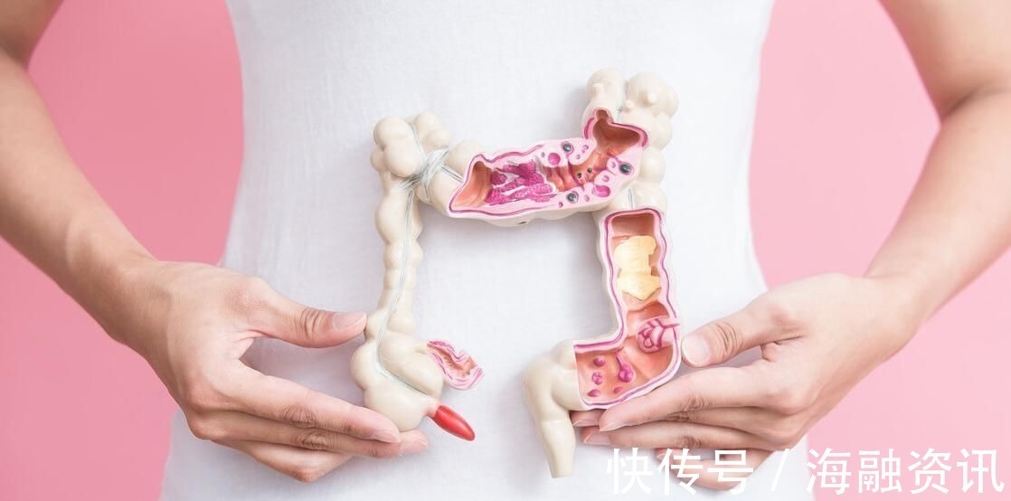 大便|肠道“清洁工”来了,有便秘困扰的就经常吃,排出宿便,小腹平坦