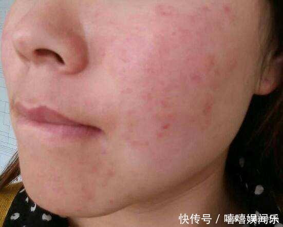 如何保养皮肤才能又白又嫩无私分享15年护肤经验,值得你一看!