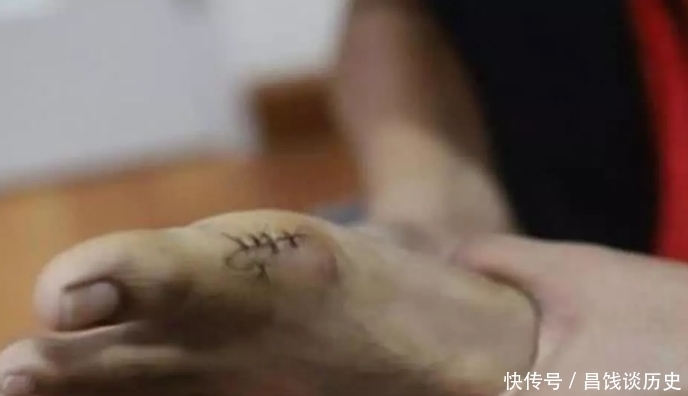 小哥|泰国小哥因cos受伤,将错就错又cos了路飞,网友:用生命在cos!