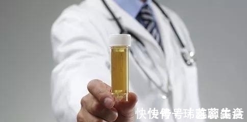 肾小球|糖尿病人尿中有泡沫,两个+专家谈治疗方案