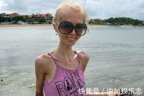 形成期|癌症形成期基本在36~45岁,若你没有这些现象,说明身体还算健康