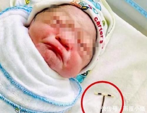 不易|女子避孕2年仍然怀孕,男宝出生时手里抓着东西曝光,活着不易