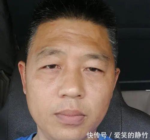 转氨酶|59岁大叔坚持吃绿豆三年,体检结果“出乎意料”,医生道出实情