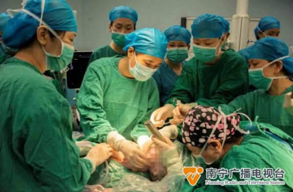 广西壮族自治区妇幼保健院|广西完成首例“产时胎儿手术” ，巨大肿瘤被成功摘除