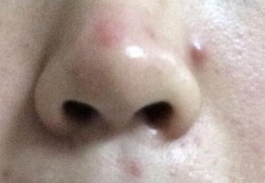 症状|女性得了妇科病都写在脸上若脸上出现4种症状,可得上心了!