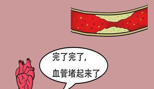  忍不住|高血脂“劲敌”并非是肉，若忍不住多吃，血脂也许会“只升不降”