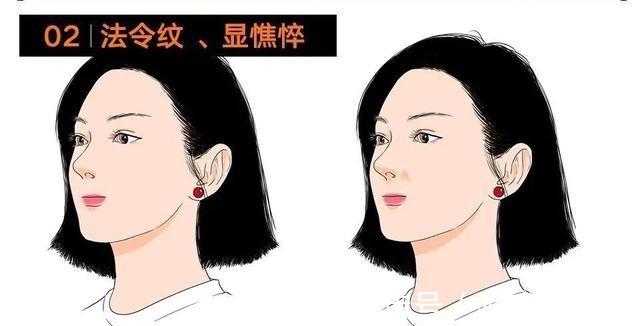 美者 鼻基底对面部影响有多大鼻基底凹陷如何改善_芯动医美课堂!