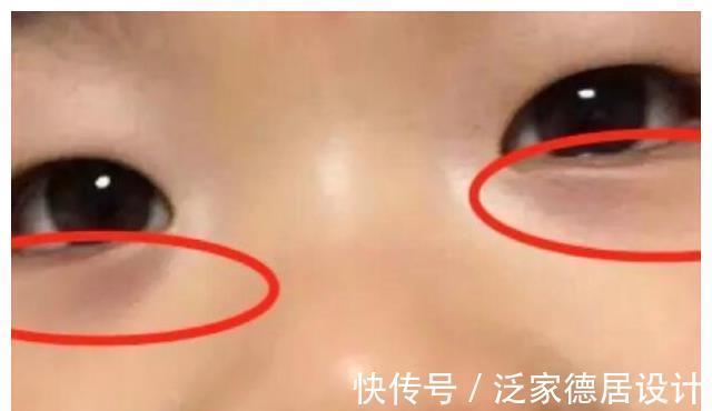 积食|6岁男孩因积食引发肠坏死，险些丧命，医生：远离3种食物是在自