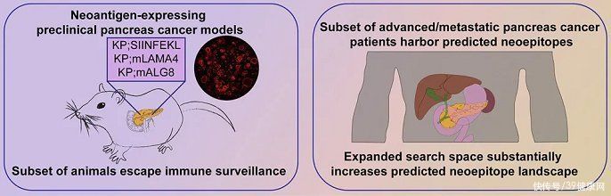 抗癌|三药联合,胰腺癌消失!专家找到“抗癌利器”,治疗后或能不复发