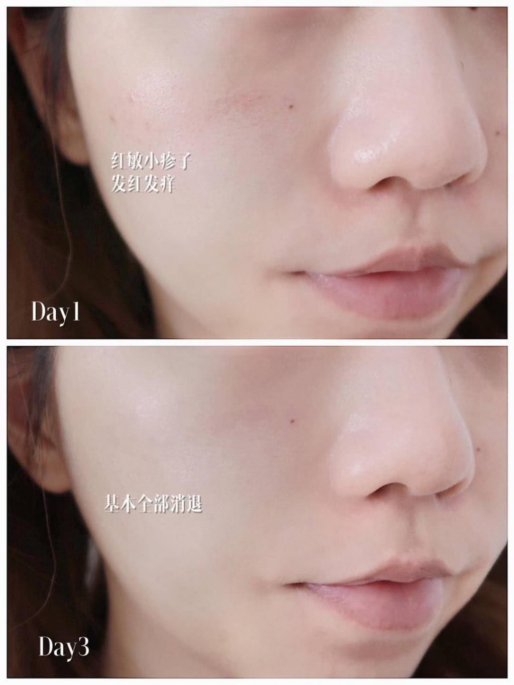 参考价|美丽零负担,夏日当前,不妨为你的肌肤减减压