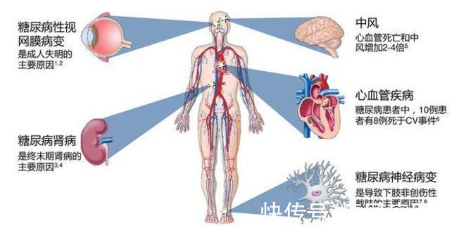 糖尿病患者|糖尿病肾病】糖尿病离尿毒症有多远？该怎样预防？
